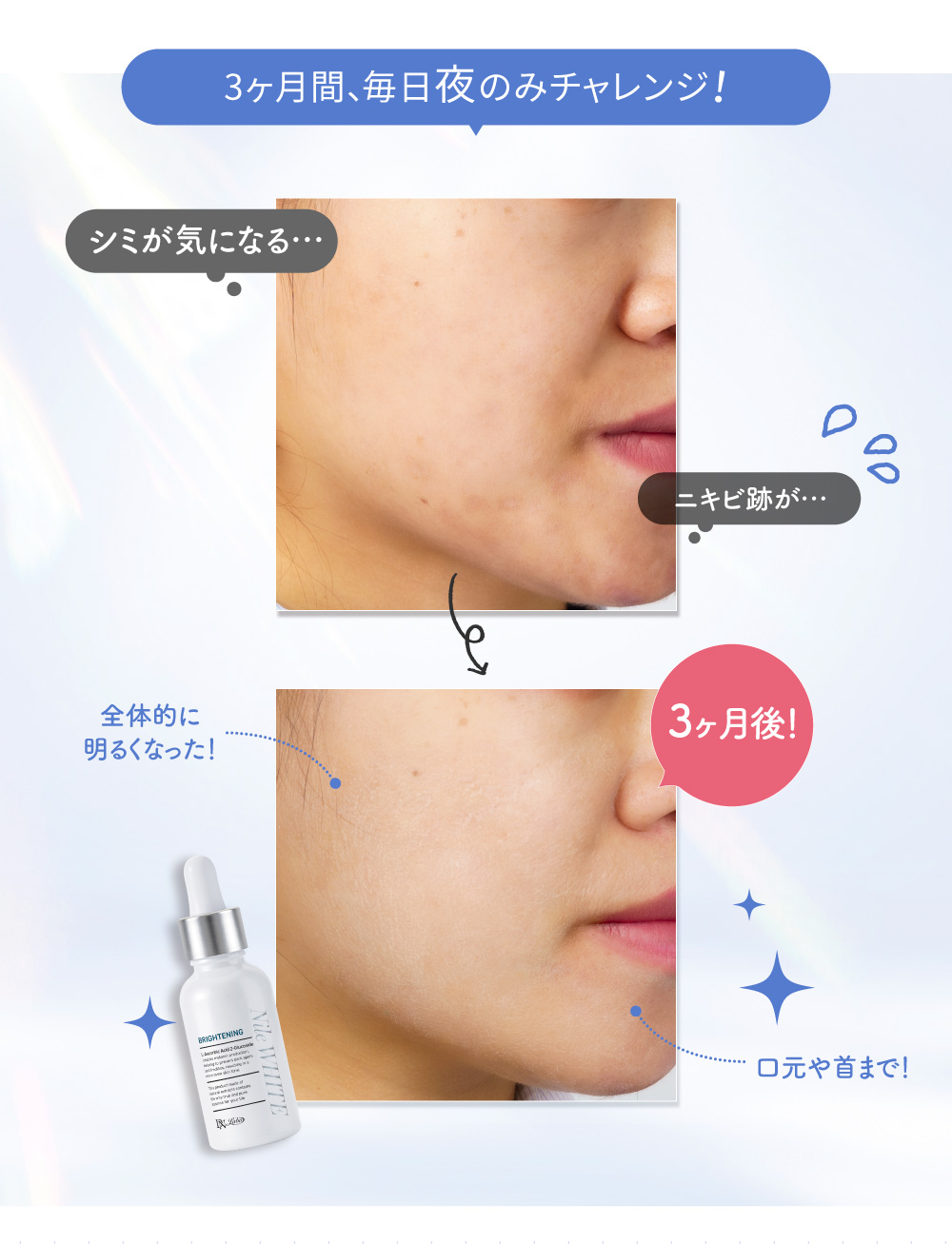 �i�C���z���C�g