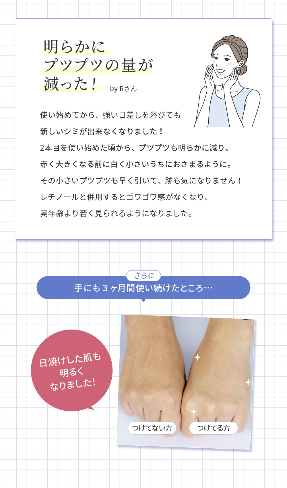 �i�C���z���C�g