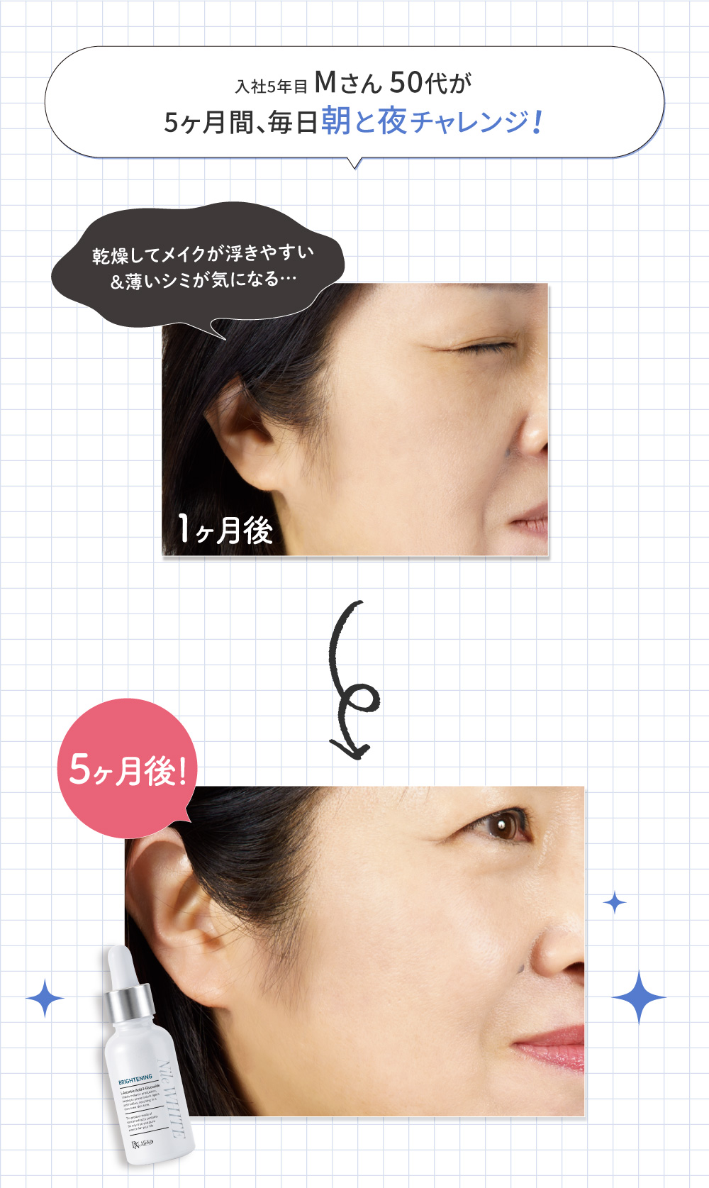 �i�C���z���C�g